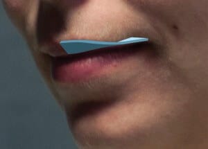 upper-lip-twist An illustration of the "twisting" orientation of the upper lip toward the corners of the mouth.