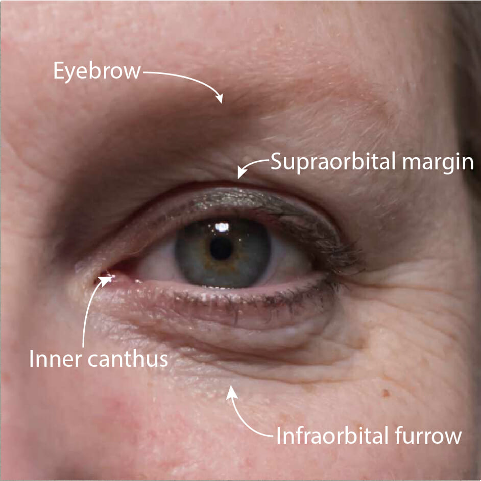 Eye reference photo with features highlighted: eyebrow, supraorbital margin, inner canthus, infraorbital furrow.